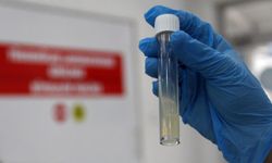 En ölümcül hastalık milyonların kabusu oldu