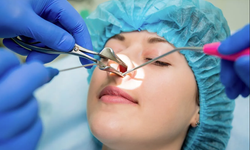 Burun eti ameliyatında modern teknikler