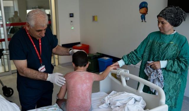 Aşırı sıcak çocuğu yaktı! İkinci derece yanık oluştu