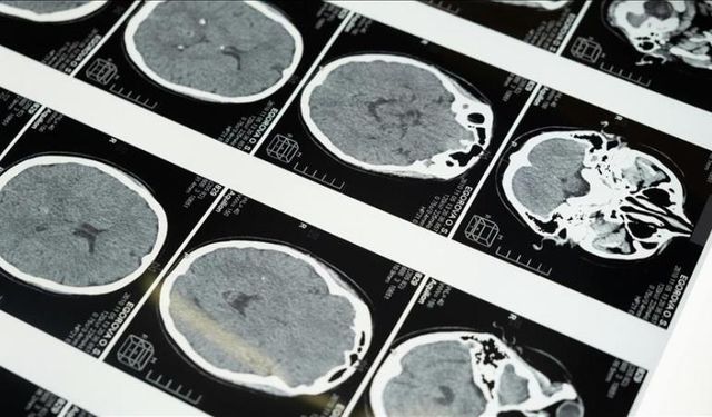 Masajın tehlikeli yüzü: Uzmanlardan uyarı geldi